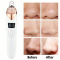 Electric Blackhead Vacuum Remover Deep Pore Cleansing Facial Skin Care Tool