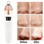 Electric Blackhead Vacuum Remover Deep Pore Cleansing Facial Skin Care Tool