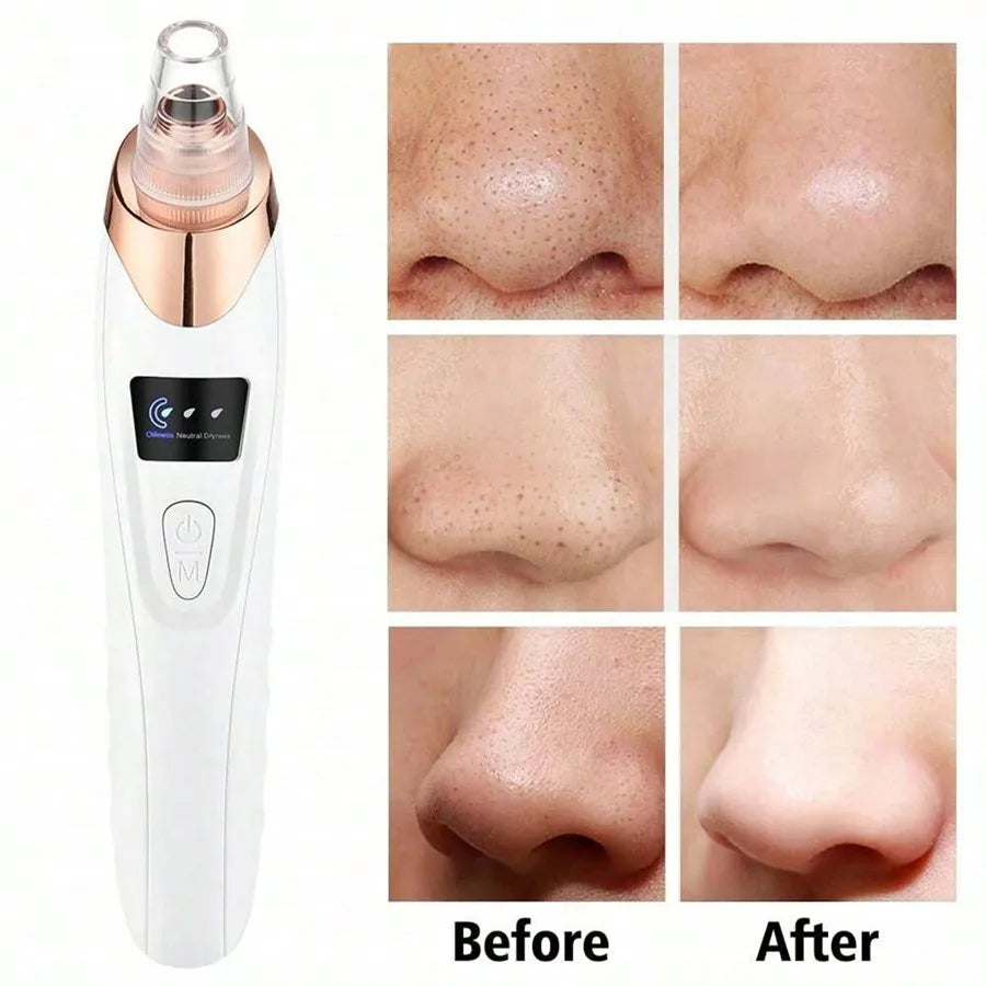 Electric Blackhead Vacuum Remover Deep Pore Cleansing Facial Skin Care Tool