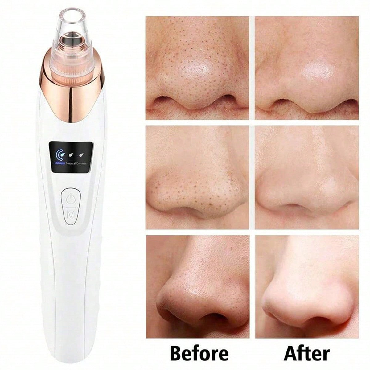 2026 Facial Pore Cleaner Blackhead Remover Vacuum USB Rechargeable