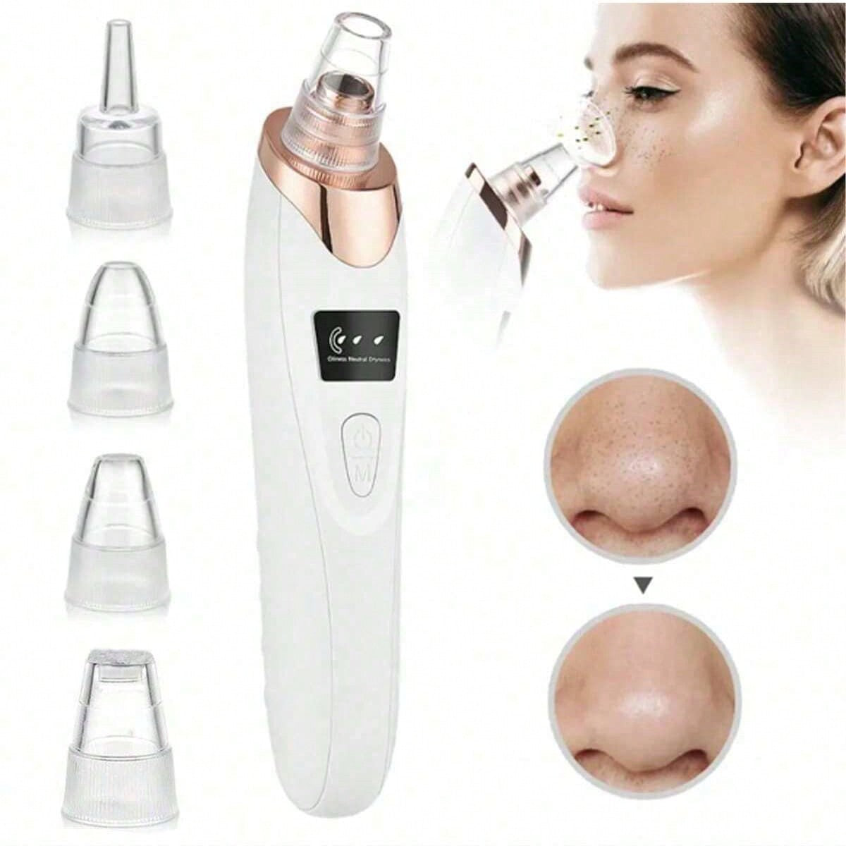 2026 Facial Pore Cleaner Blackhead Remover Vacuum USB Rechargeable