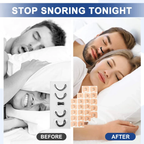 Magnetic Nasal Strips Anti Snoring Solution Improve Sleep Quality