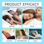 Magnetic Nasal Strips Anti Snoring Solution Improve Sleep Quality