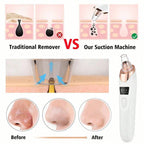 2026 Facial Pore Cleaner Blackhead Remover Vacuum USB Rechargeable