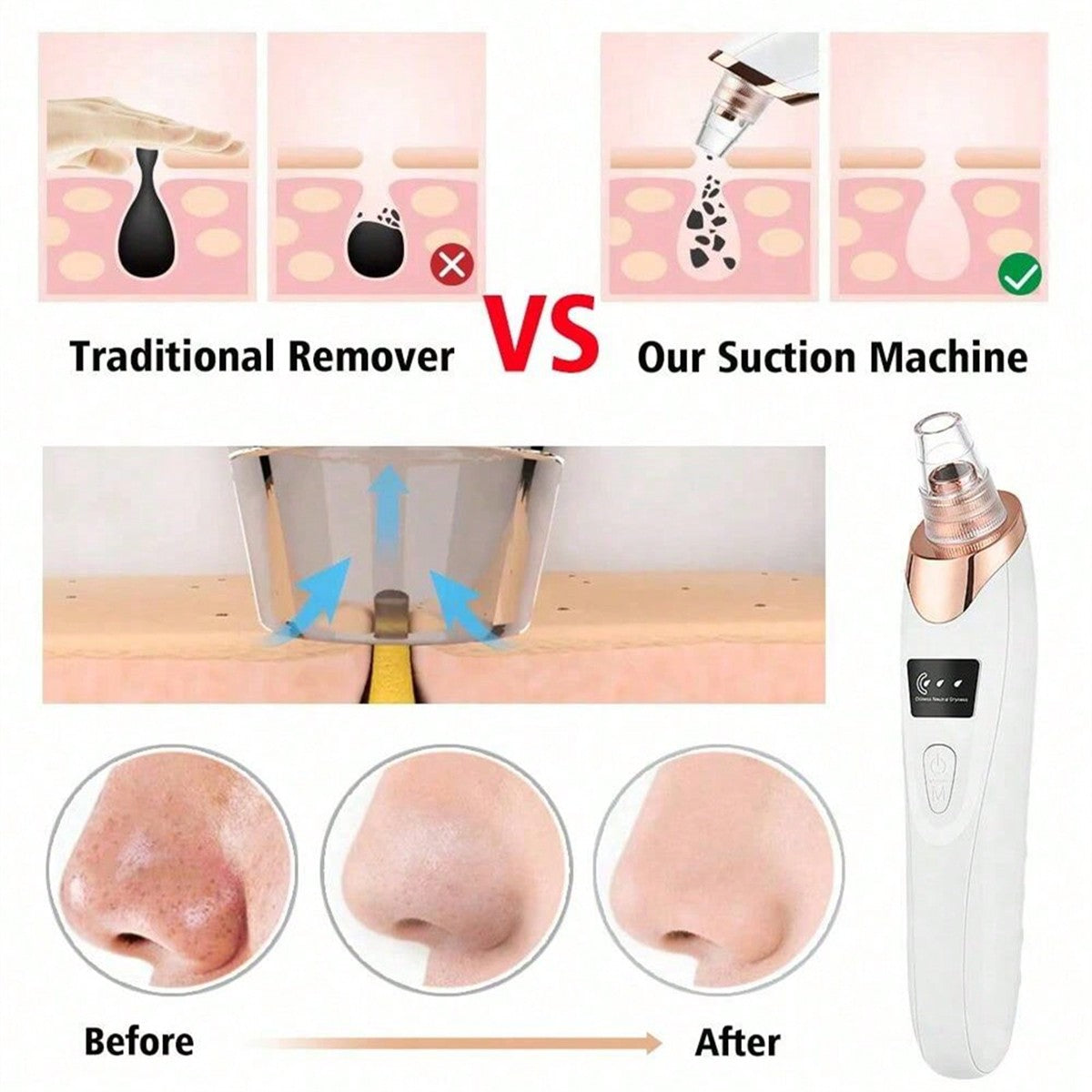 2026 Facial Pore Cleaner Blackhead Remover Vacuum USB Rechargeable