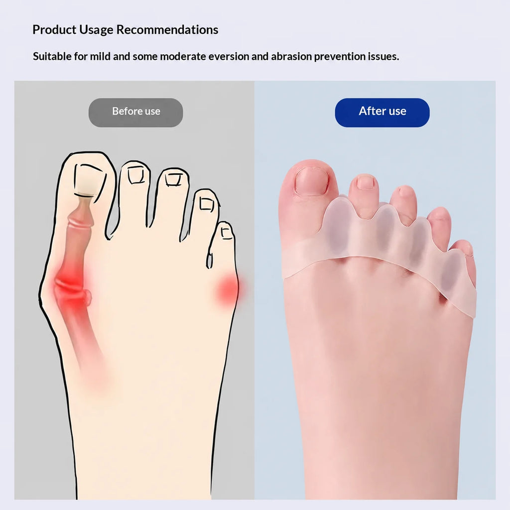 Pair of Silicone Toe Corrector | Meeesho.pk