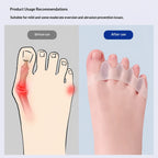 Pair of Silicone Toe Corrector | Meeesho.pk